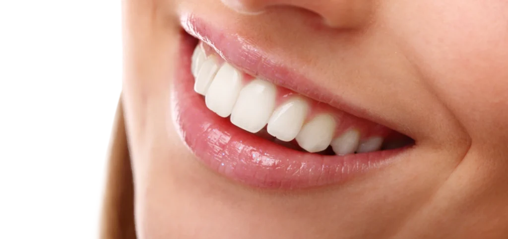 traitement esthetique dentaire montauban Recommandations pendant un blanchiment Chirurgiens-dentistes à Montauban