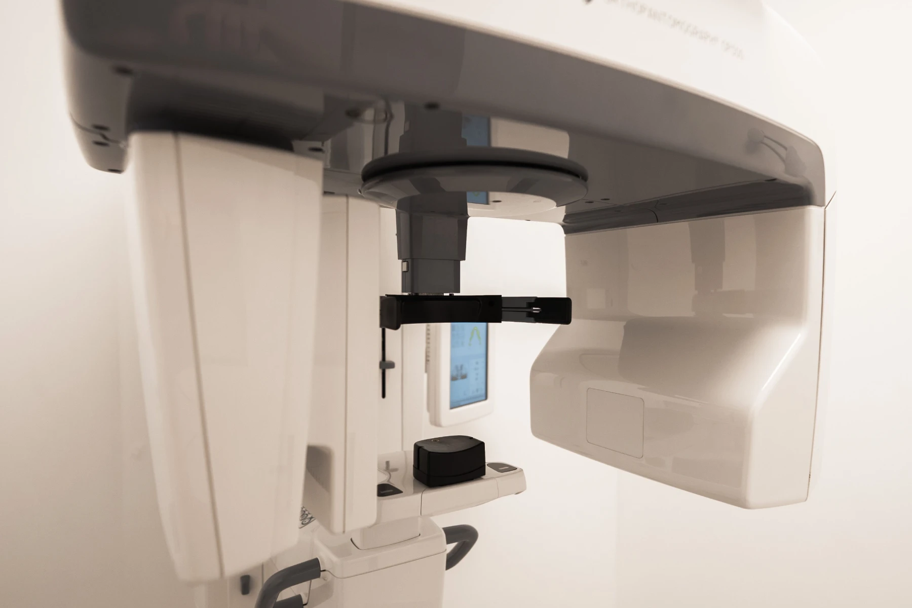 radio-panoramique-dentaire montauban